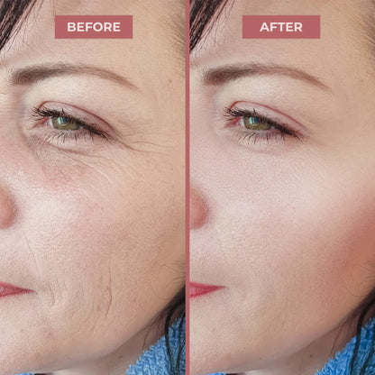 Calcium Multi Balm | Voted Best Beauty Product in Canada